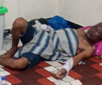 Ayah dan Anak Balita Jadi Korban Ledakan di Labuan Bajo