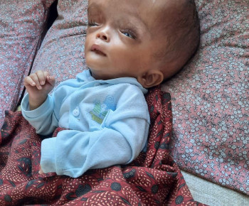 Gevan, Bayi Mungil Penderita Hidrosefalus Butuh Bantuan Orang Baik