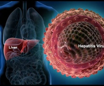 Satu Anak di Tulungagung Meninggal, Diduga akibat hepatitis akut