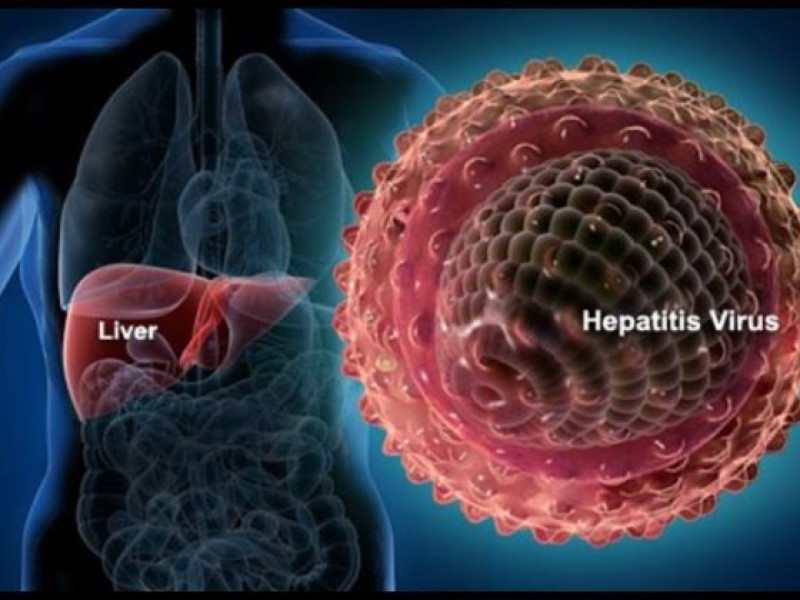 Satu Anak di Tulungagung Meninggal, Diduga akibat hepatitis akut