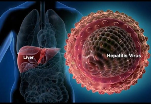 Hepatitis Akut misterius