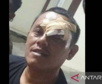 Gusti, Wartawan yang Diculik dan Disekap hingga Cecoki dengan Air Kencing