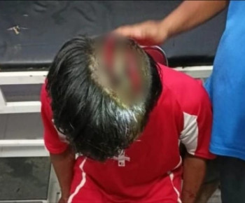 Mengerikan Adi Saputra Diterkam Harimau, Kepalanya Sampai Terbelah