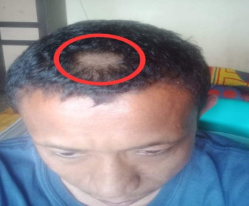 Geram, Rambut Guru Ulan Hadji Digunting Paksa Orang Tua Murid Balas Dendam Rambut Anaknya Dicukur
