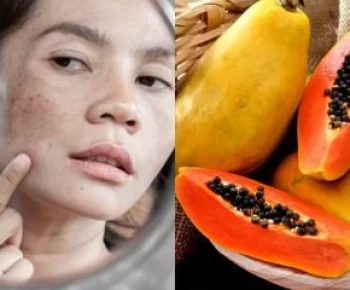 Tak Perlu Beli Krim, Cuma Modal Pepaya dan Jeruk Nipis Flek Hitam Lenyap