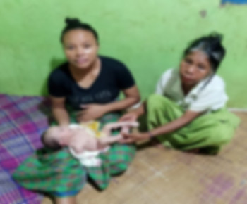 Bayi Lahir Tanpa Anus di Manggarai Butuh Uluran Tangan