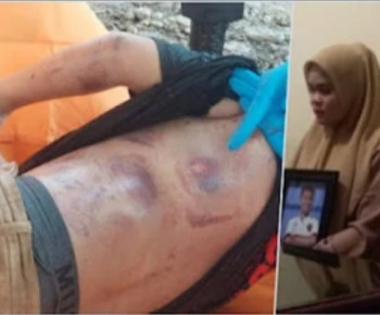 Pengakuan Orang Tua Siswa SMP di Padang Tewas Diduga Disiksa Polisi, Sempat Video Call