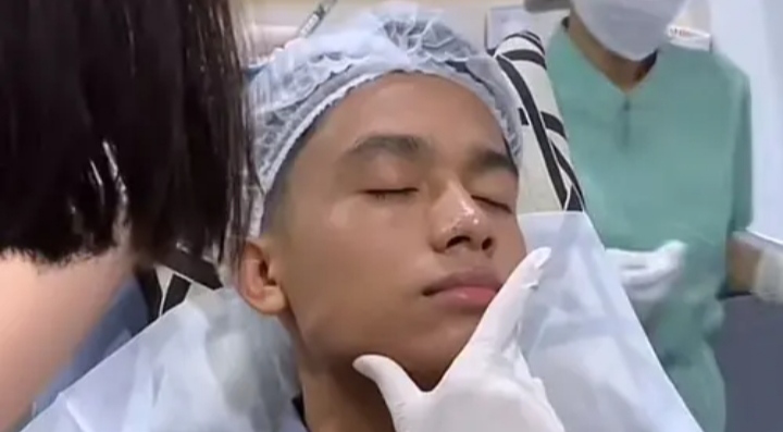 Filler Dagu