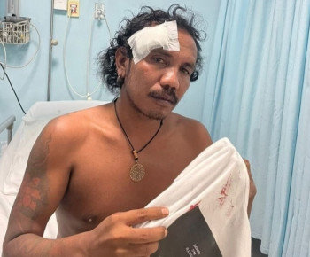 Doyan Miras dan Anarkis, Kapolda NTT Diminta Evaluasi Menyeluruh Mental Anggota