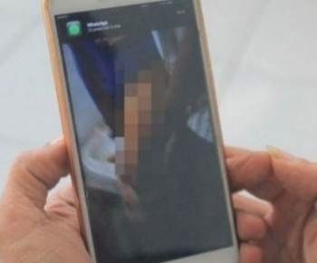 Dokter Cabul di NTT, Paksa Mahasiswi Perawat VCS: Ini Aturan di RS!