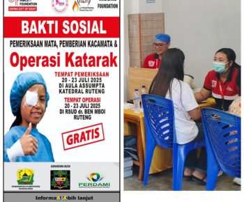 Operasi Katarak di Manggarai Targetkan 400 Pasien, Solusi Kesehatan Mata Tanpa Biaya