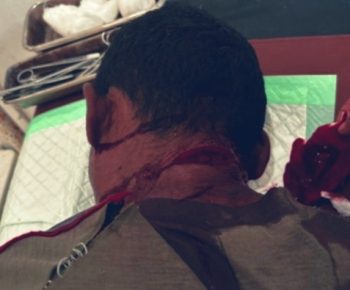 Tragis, Ayah Lansia di NTT Ayunkan Parang ke Anak Kandung hingga Luka Serius